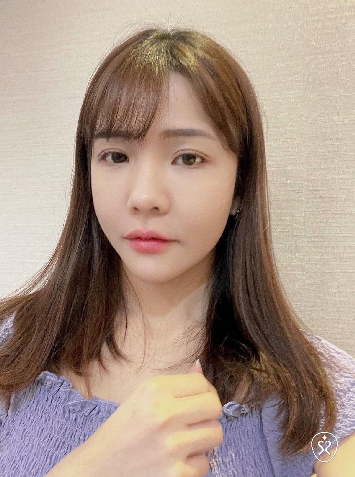 陳依婷醫師細心諮詢玻尿酸療程